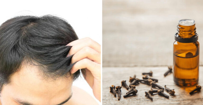7 Clove Oil Benefits That Are All Talk and 5 That Actually Work