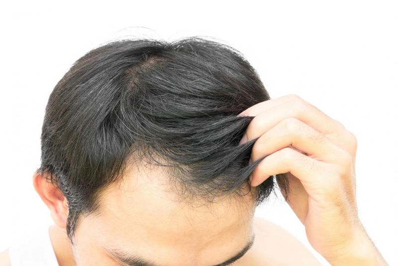 Hair Growth Booster