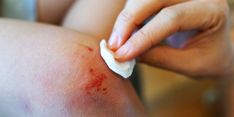 Minor Cut or Scratch Disinfectant